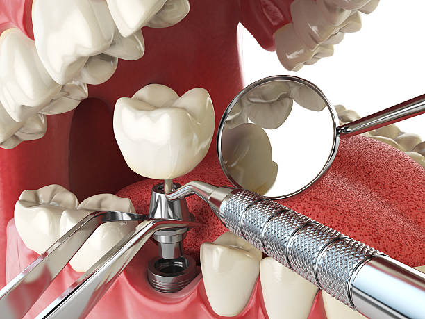 Best Root Canal Emergency Dentist  in Western Springs, IL